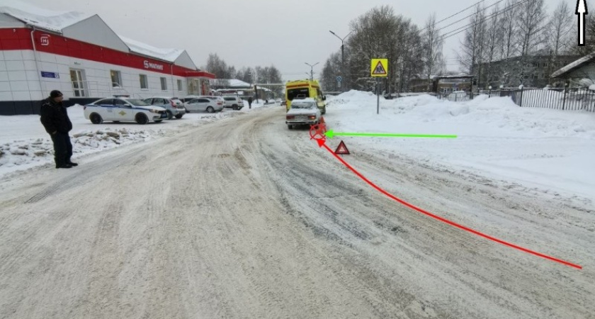 Сыктывкарка попала под машину, пересекая дорогу в неположенном месте